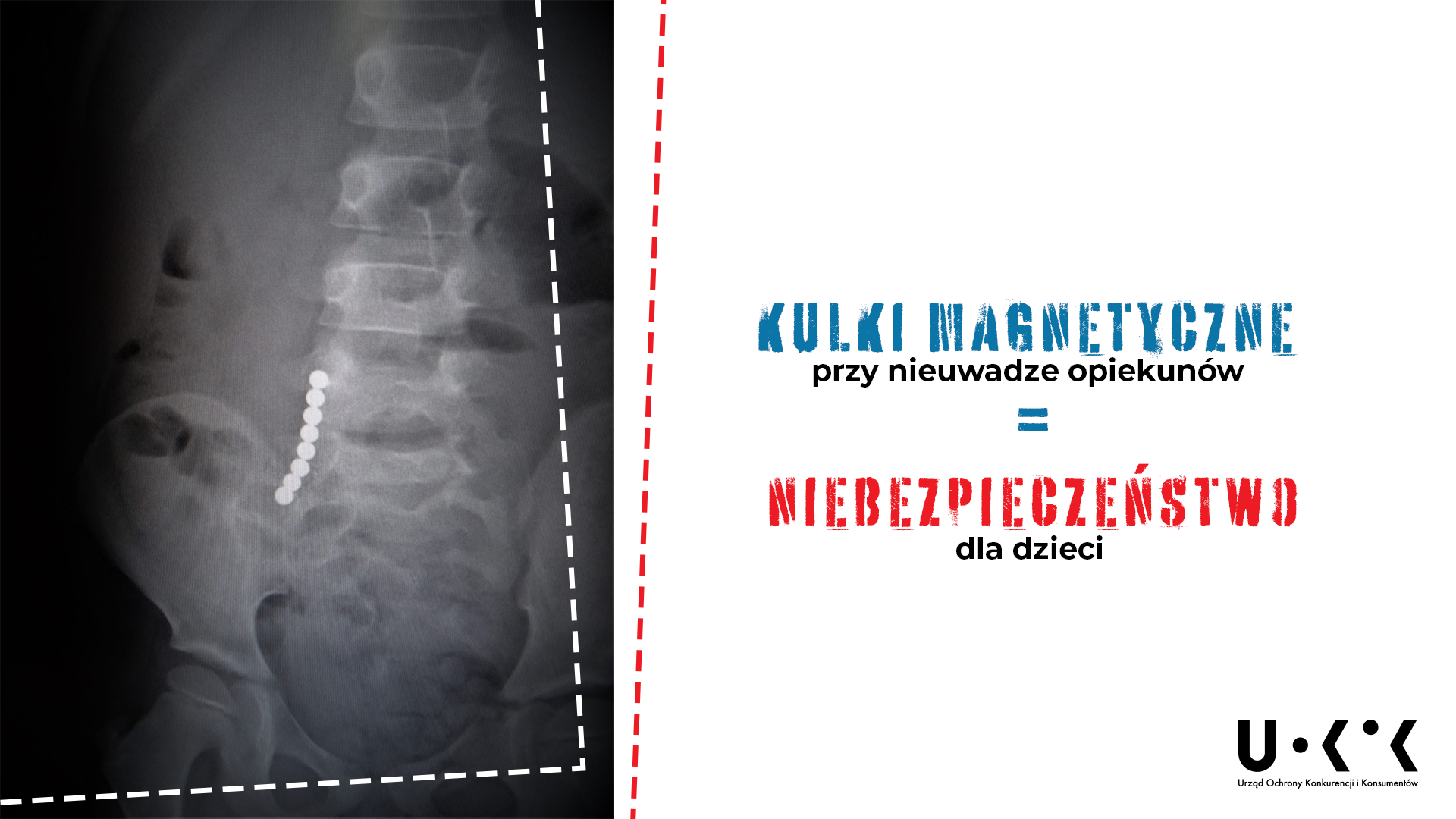 NIEBEZPIECZNE ZABAWKI - KULKI MAGNETYCZNE, zdjęcie prześwietlenia ukazujące położenie kulek wewnątrz organizmu ludzkiego